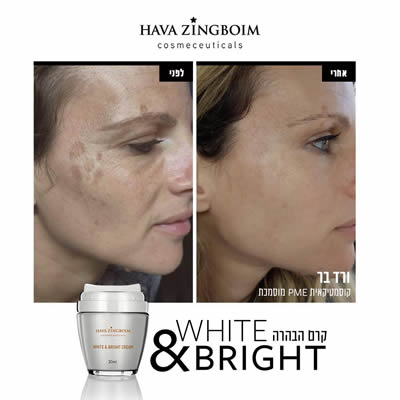 טיפול בהבהרה מיכל קוסמטיקאית בשינקין תל אביב